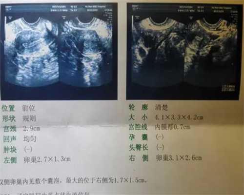 惠州试管婴儿医院排名，2024哪家助孕成功率更高一目了然